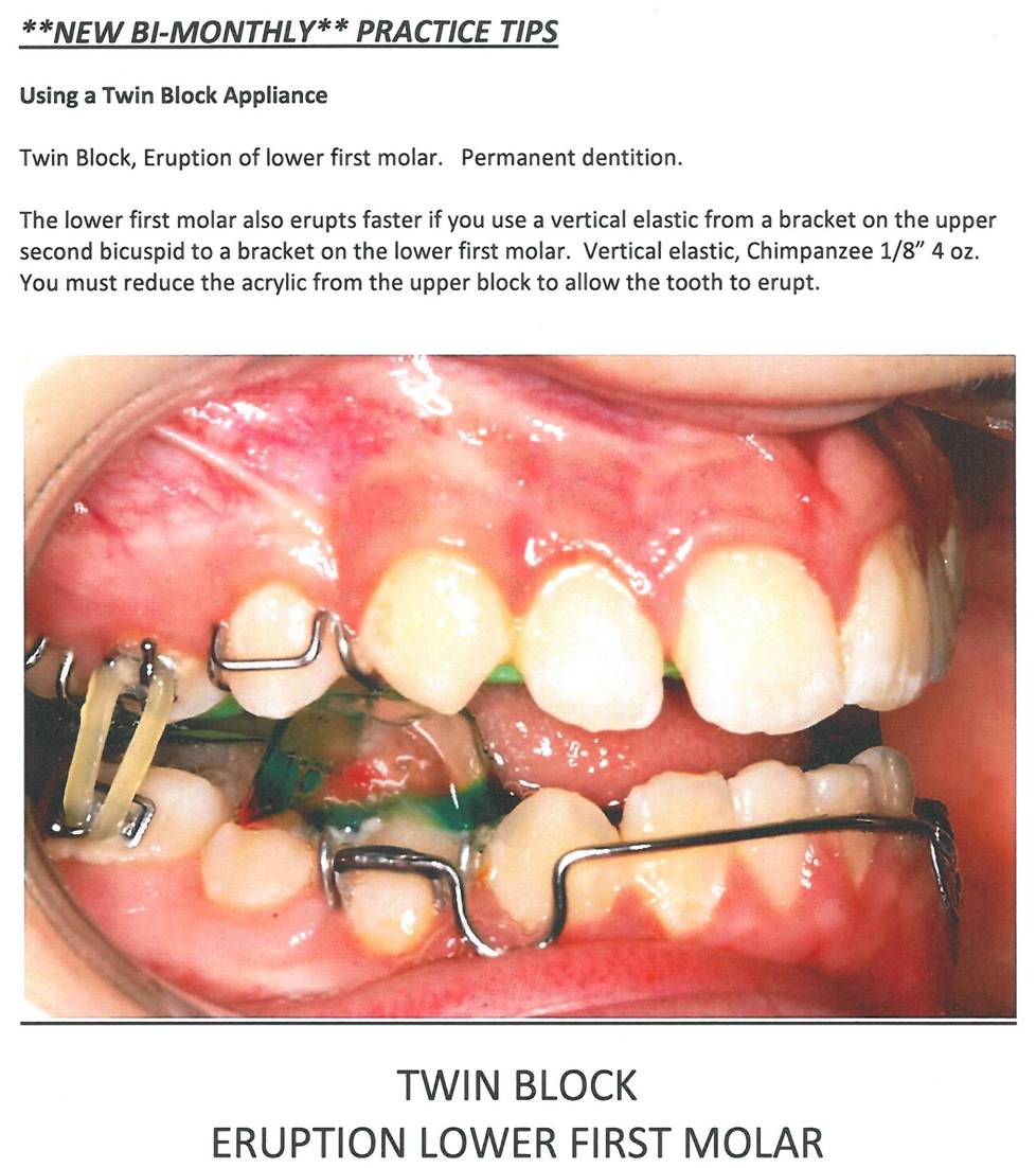 Practice Tip 13 Using a Twin Block Appliance Rondeau Seminars