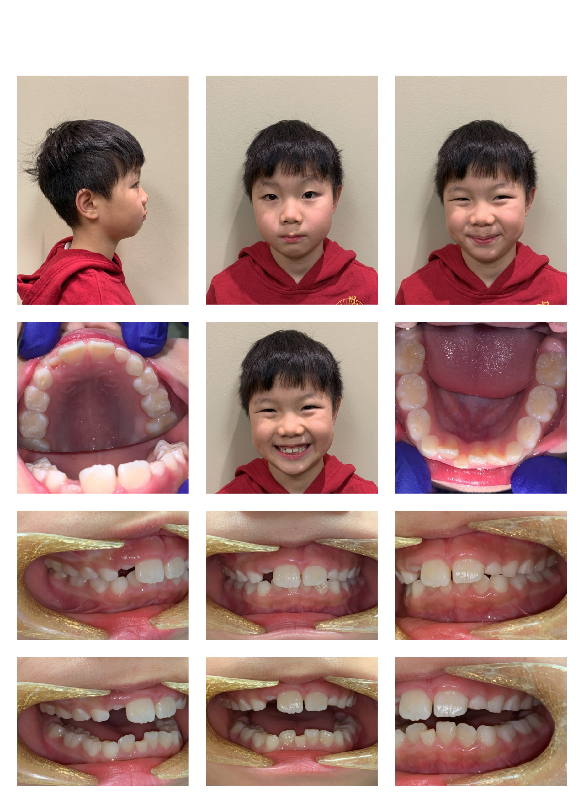 12607285_Lin_Jayden_Composite
