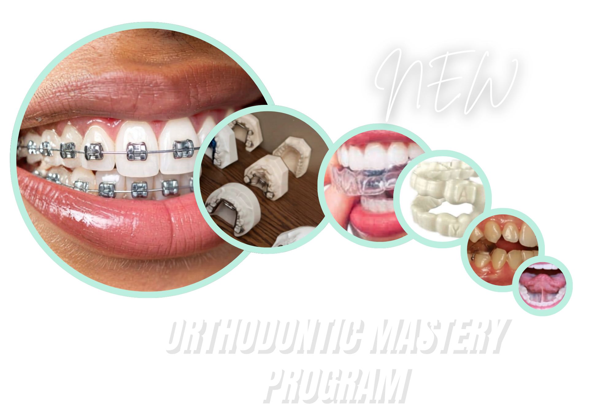 Updated Rondeau Image